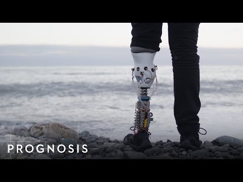 En MIT-ingeniør bygger sin egen bioniske benprotese