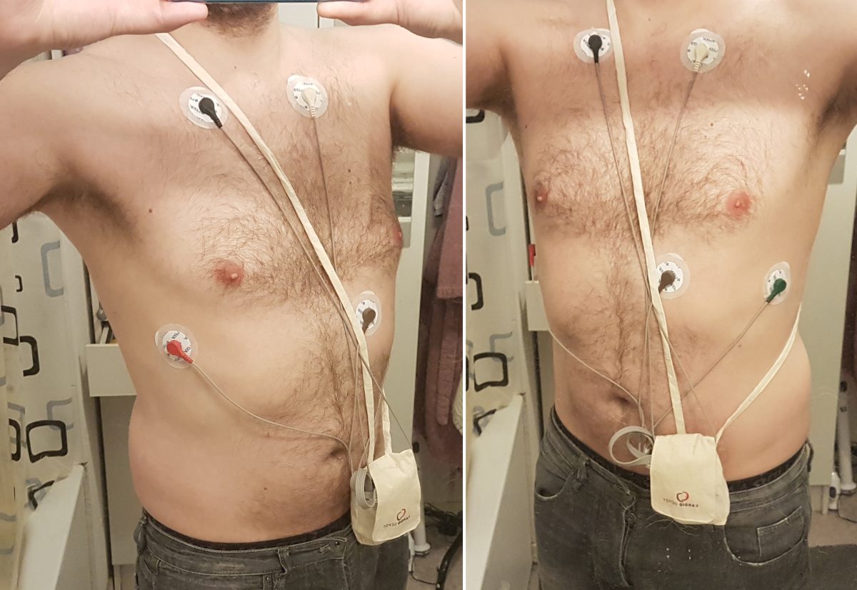 Having a Holter monitor fitted