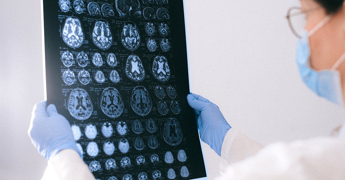 Researcher in white coat analyzing neurons and brain plaques under a microscope
